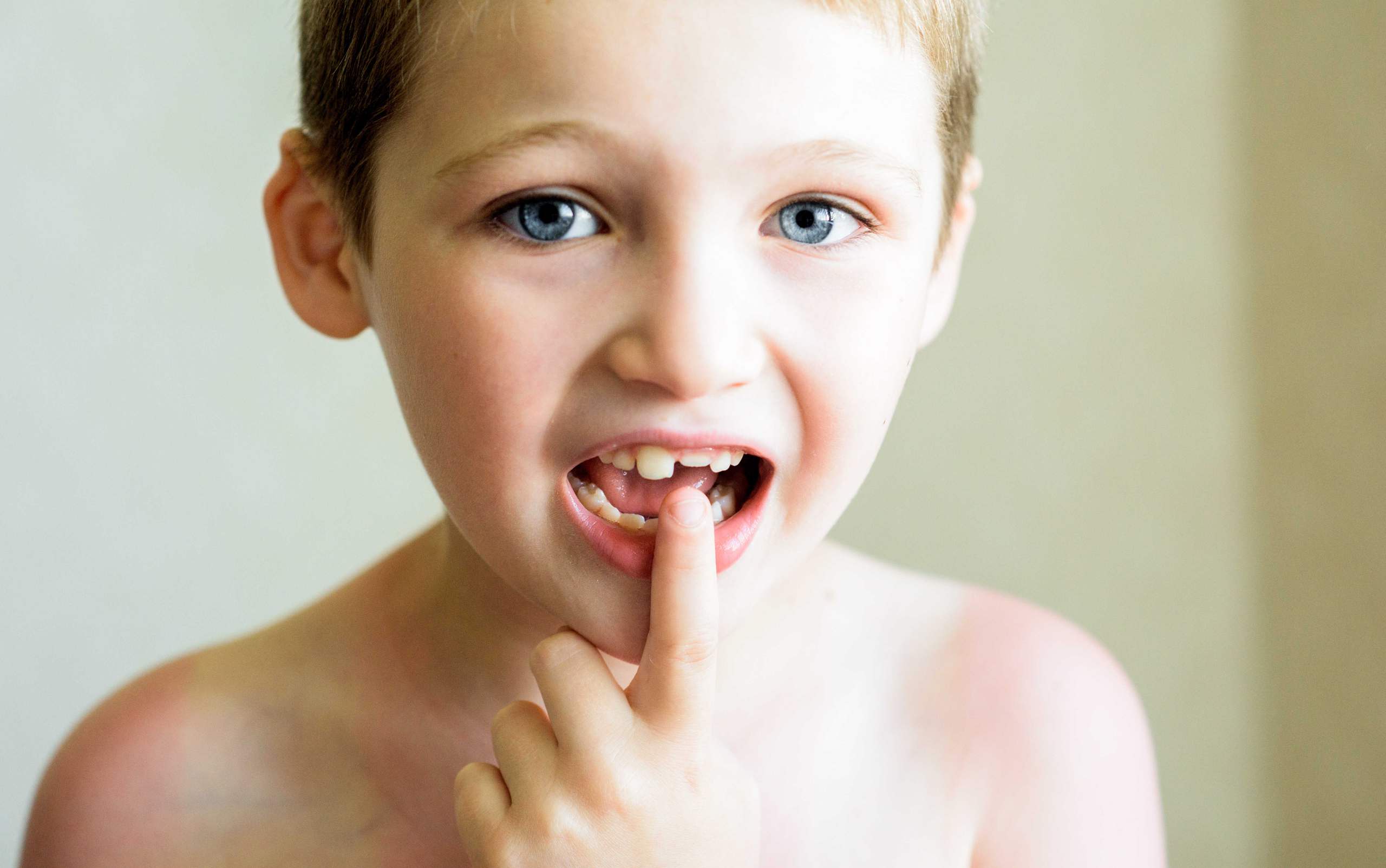Kid Chipped Tooth