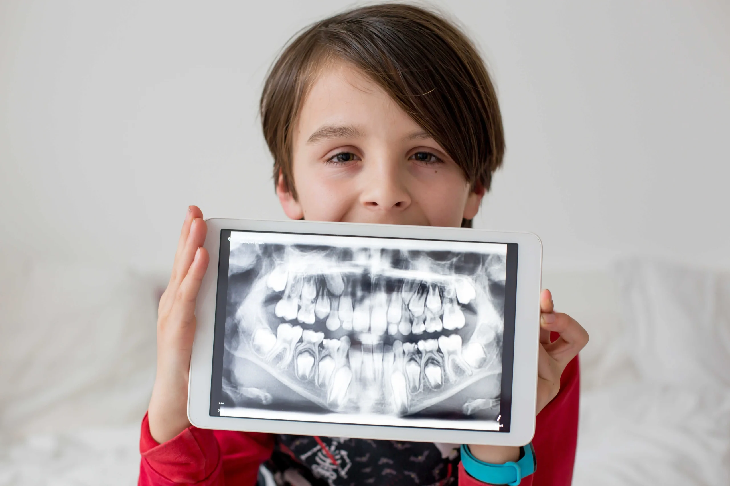 Dental X-Rays