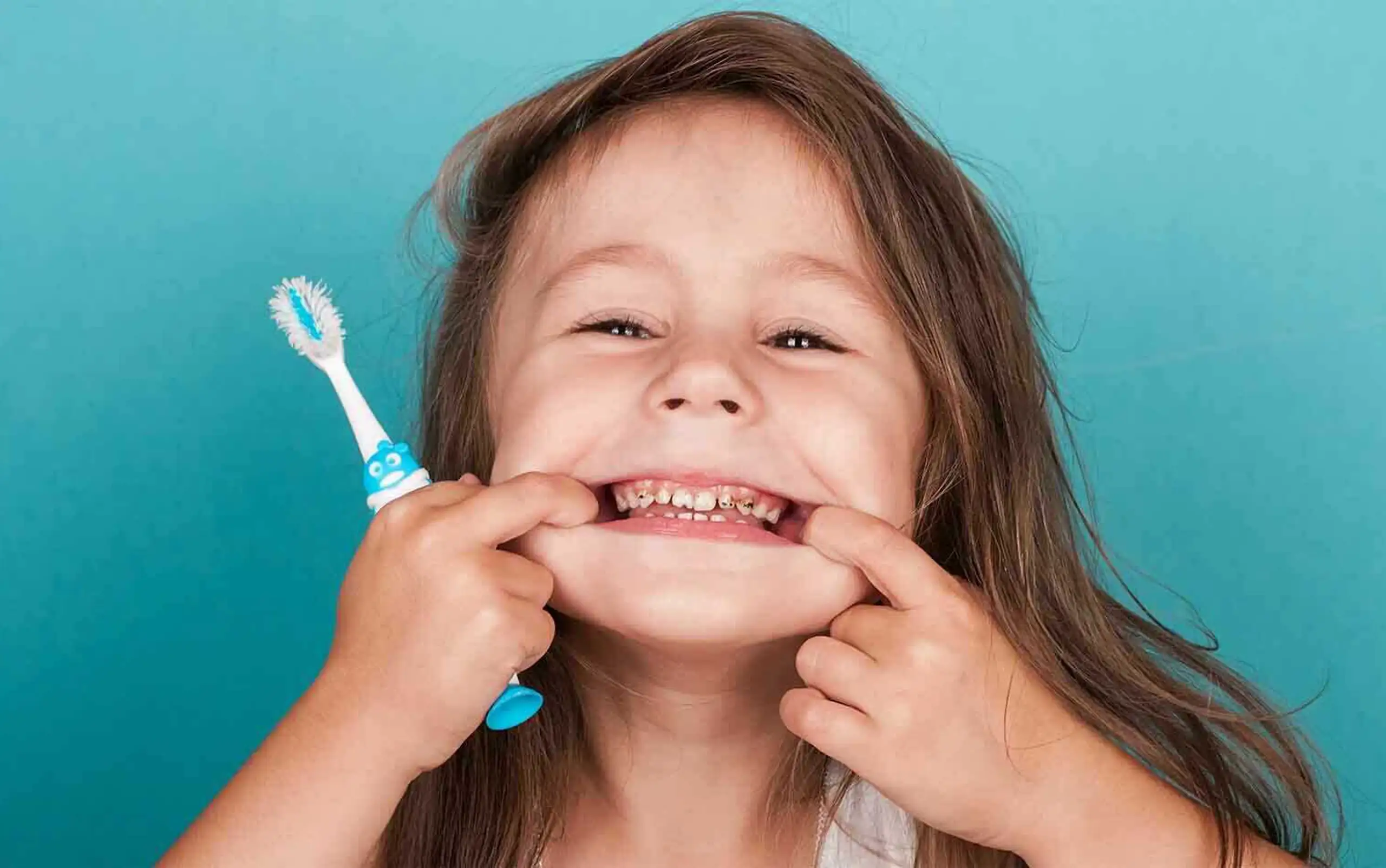 Tooth decay