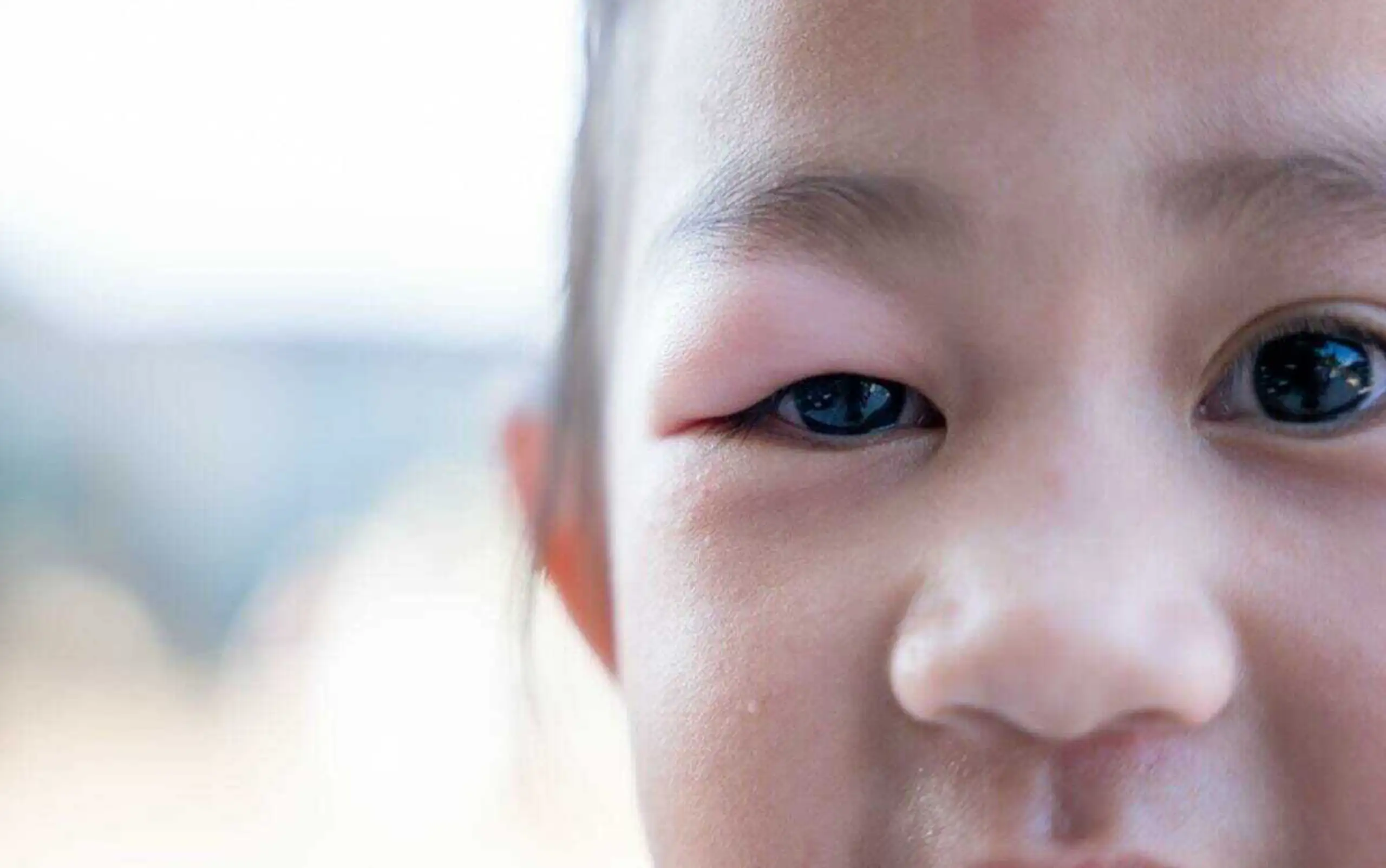 hild stye in eye